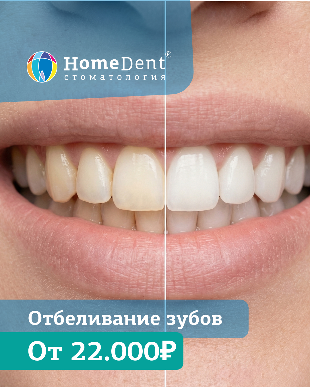 Белоснежная улыбка