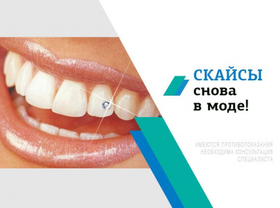 Скайсы снова в моде!