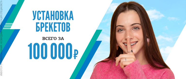 Брекеты - 100000 руб