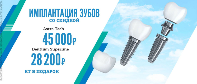 Импланты Astra Tech